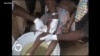 LAFIYARMU: Hukumar Lafiya Ta Duniya Ta Ce An Samu Nasarori Wajen Kawar Da Cutar Kurkunu Wato Guinea Worm A Turance