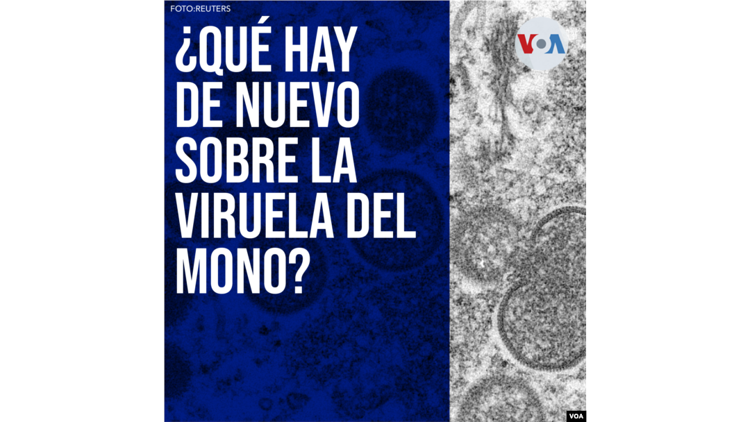 ¿Qué hay de nuevo sobre la viruela del mono?