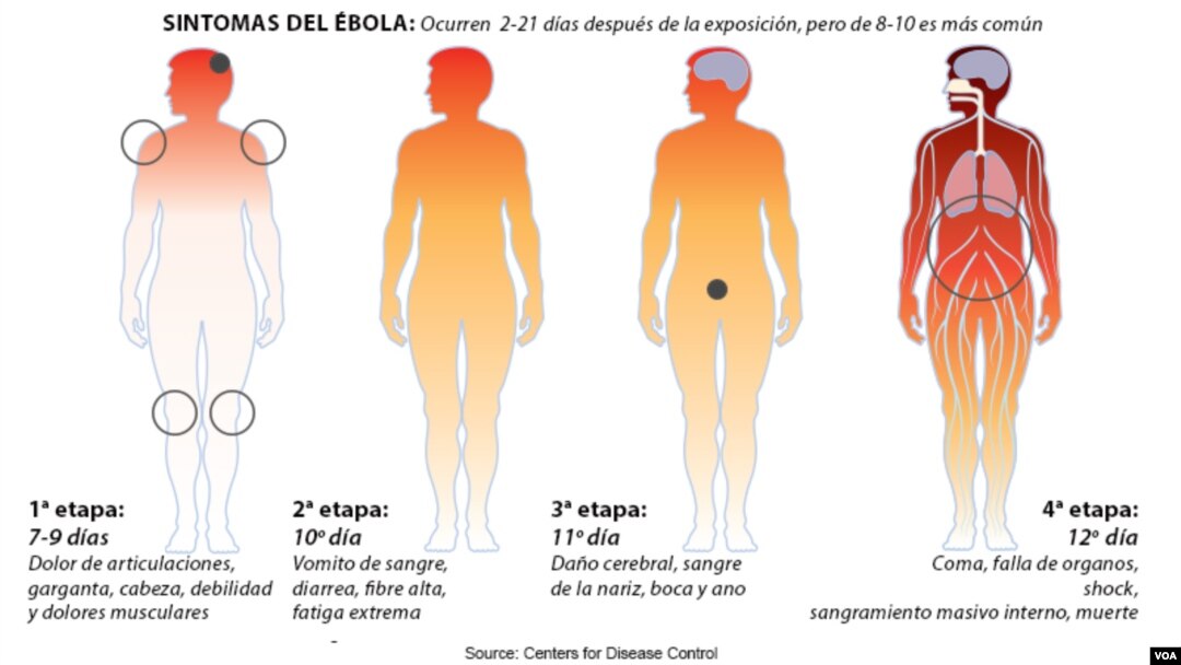 Las etapas del ébola y cómo va afectando al organismo